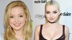 Dove Cameron Nose Job And Lip Injections - Celebrity Plastic