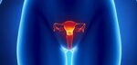 Women With HIV Have Higher Risk of Failed Cervical Precancer