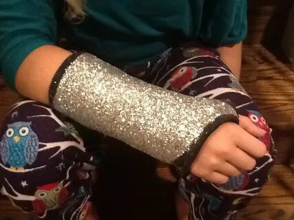 Arm cast, Cast decoration, Broken wrist