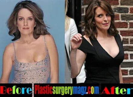 Tina Fey Plastic Surgery Before and After Tina Fey Face Scar