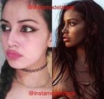 Cindy Kimberly Before And After Plastic