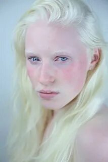 you.little.dark.one (With images) Albino girl, Albinism, Pal