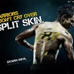 "Nike - Warriors Don’t Cry Over Split Skin" Sports marketing