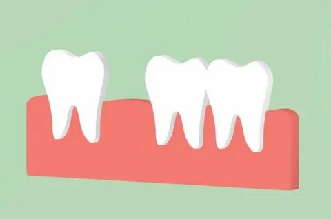 Step Decay Tooth Dental Cartoon Render Flat Style Cute Chara