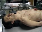 Autopsy Body - Vincent Van Dyke Effects
