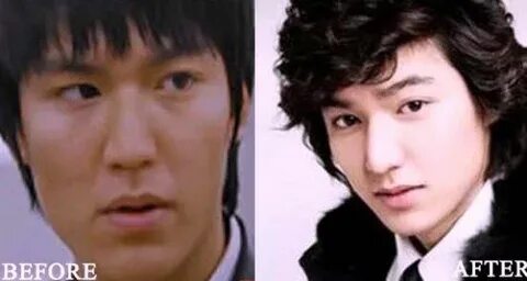 Lee Min ho Plastic Surgery Before and After Photo in 2019 pl