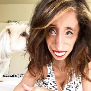The World's Ugliest Woman Lizzie Velasquez is fighting back.