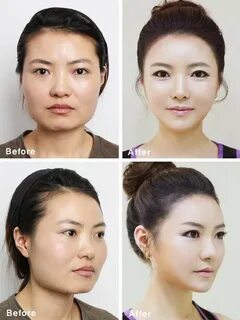 If you want to be beautiful, you’ll have to buy a new face -