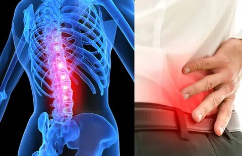 What Exactly is Spinal Stenosis? Spine Works Institute
