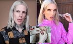 Jeffree Star Teeth Before And After