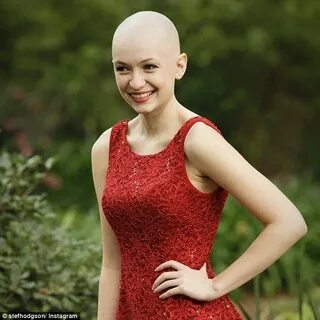 Woman living with alopecia opens up about her 'tortuous' hai