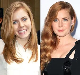 Amy Adams Hair