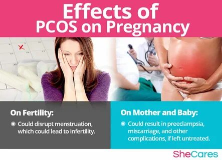 PCOS and Getting Pregnant SheCares