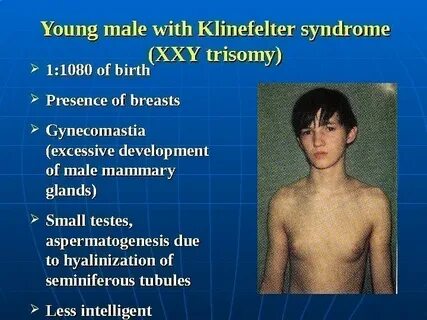 TOPIC: Human hereditary diseases. Chromosomal