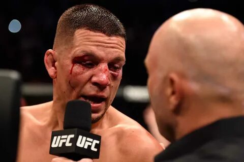 Nate Diaz Makes Interesting Point About Conor McGregor Remat