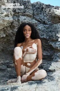 Winnie Harlow Nude The Fappening - Page 14 - FappeningGram