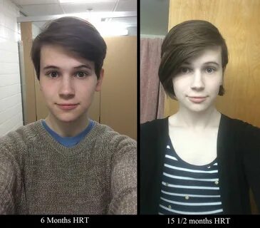 Face changes over 9 months! Hair growth + time = finally see