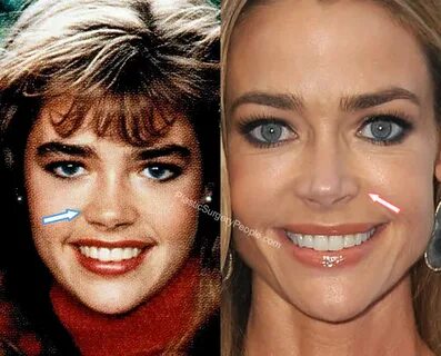 Denise Richards: BEFORE and AFTER 2019