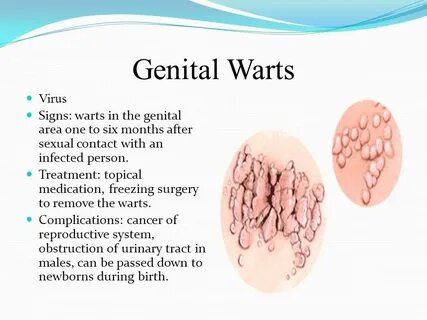 Genital Warts Virus. 