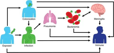 Streptococcus pneumoniae outbreaks and implications for tran