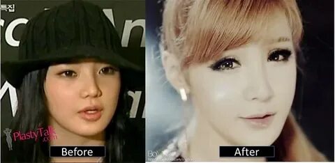 Park bom plastic surgery ✔ Chelsea Clinton Plastic Surgery B