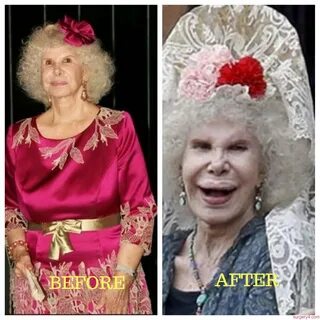 Duchess of Alba Plastic Surgery Photos Before & After - Surg