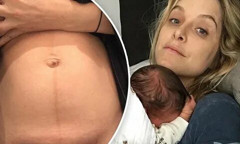 Jenny Mollen shows C-Section scar after son's birth