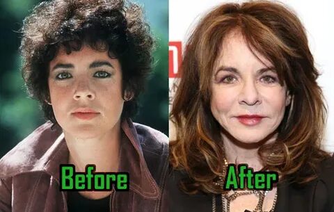Stockard Channing Plastic Surgery Drastically Changed Her Fa