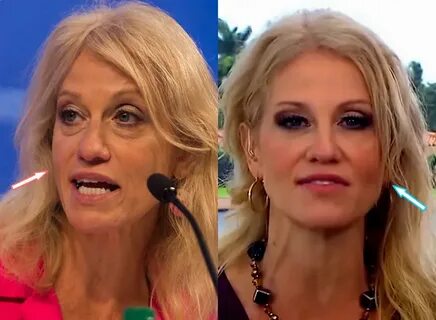 Did kellyanne conway have plastic surgery - Plastic Surgery