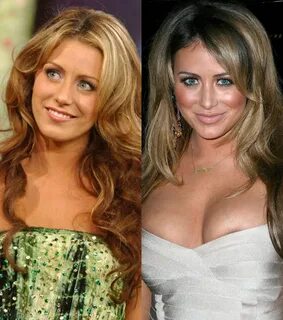 Aubrey O’Day before and after plastic surgery Celebrity plas