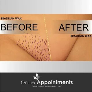 Hair Growth After Brazilian Wax : Everything You Need To Kno