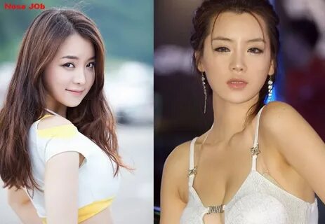 Im Ji Hye Plastic Surgery Before And After Photos
