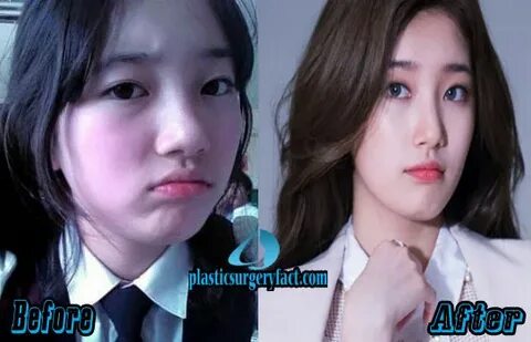 Bae Suzy Plastic Surgery - About Lee Dong-wook: Profile, Fam