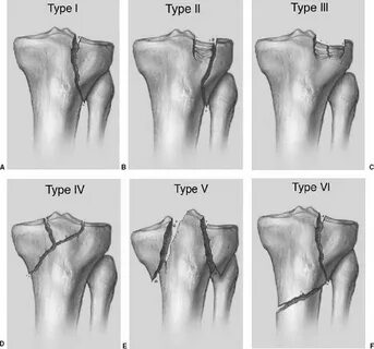 The Knee Radiology Key