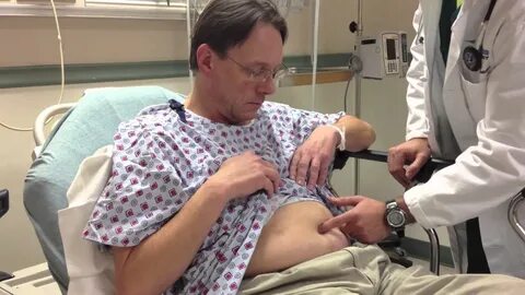 umbilical hernia exam - version 2 (edited audio) - YouTube