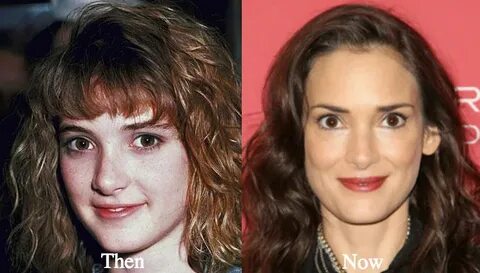 Winona Ryder Plastic Surgery Before and After Photos