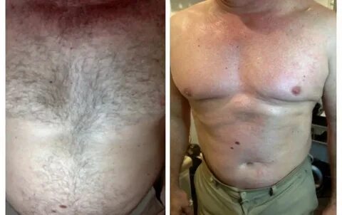 Before After Photo, Before After İmage... Brazilian waxing W