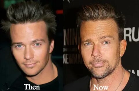 Sean Patrick Flanery Plastic Surgery Before And After Photos