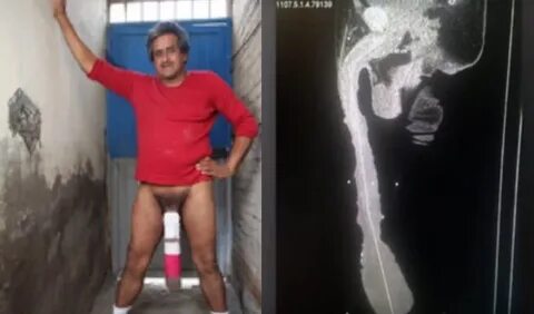 El hombre con el pene mas grande del mundo - Experto Masculi