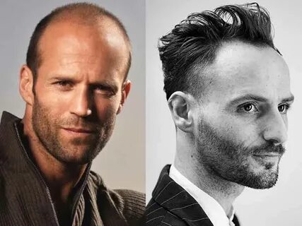 11 Hairstyles For Men With Thin Hair And Big Forehead - Lewi