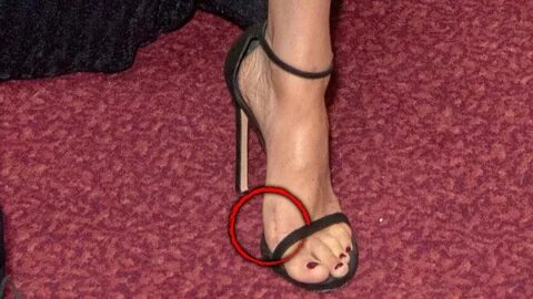 What’s That Scar on Meghan Markle’s Foot? - YouTube