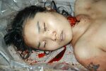 Autopsy of a cute Chinese girl killed by cutting her throat 