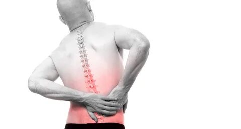 Rückenschmerzen: Keine Evidenz für Gabapentin und Pregabalin