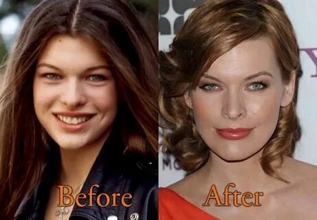 Milla Jovovich Plastic Surgery All in one Photos