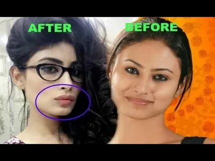 Mouni Roy Lip Job - Before And After - YouTube