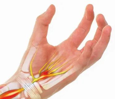 Боль в запястье руки правой или левой: причины, лечение и уп