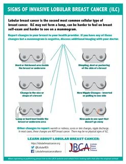 infographic showing changes in the breast that might indicate lobular breas...