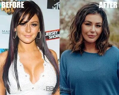 Jennifer Lynn Farley (Jwoww) Plastic Surgery Before and Afte