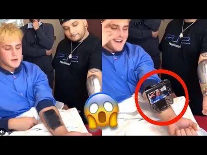 JAKE PAUL gets a CAMERA implanted into his arm. *full clip* 