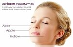 Voluma XC - The Next Generation in Facial Rejuvenation Juved